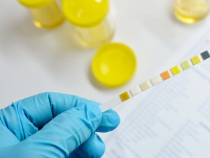 Urine Test to Determine a Healthy Diet
