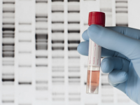 DNA Genetic Testing